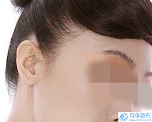 段瑞平做內(nèi)窺鏡隆胸價格有哪些因素