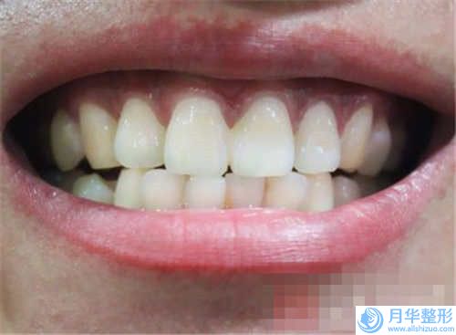 平?jīng)鍪懈共抗舱裎瑴p肥醫(yī)生上榜清單受眾人高捧-陳叢笑整形醫(yī)生是否信得過