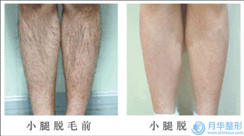 漳州提升緊致面部肌膚價格高不高呢