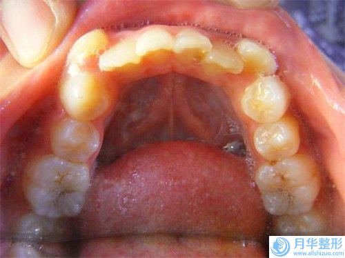 煙臺(tái)王玉珍整形外科吸脂減小腿怎么樣項(xiàng)目技術(shù)檔次