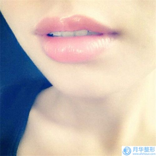 淮南膨體隆下巴美容禁忌人群「淮南膨體隆下巴整形手術(shù)比較適合哪些人」