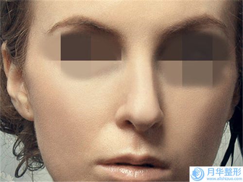襄陽美萊醫(yī)療整形美容醫(yī)院鼻梁骨歪曲矯正全部手術費用大概需要多少