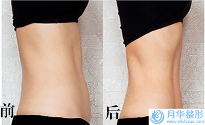 磨骨臉醫(yī)院推薦：磨骨臉醫(yī)院前20名權(quán)威一覽