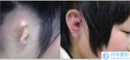 衡水水滴型假體豐胸價(jià)格多少合理