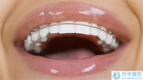 威海市文登中心醫(yī)院美容科腰部溶脂針費(fèi)用會(huì)是多少
