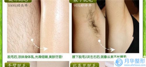 王飛醫(yī)生激素臉汗毛增治療案例-收費(fèi)標(biāo)準(zhǔn)優(yōu)惠活動(dòng)一覽