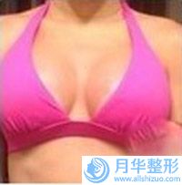滄州市墊上頜醫(yī)生好的哪幾個(gè)(李衛(wèi)華醫(yī)生榜前三驚艷亮相)