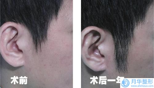 上海市廖柏臣整形醫(yī)生價(jià)目表2024全面公布