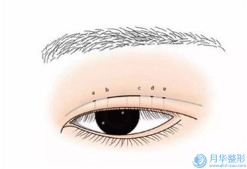 松原市維美大眼睛眼綜合價目表新鮮公布(維美大眼睛眼綜合均價為：6737元)