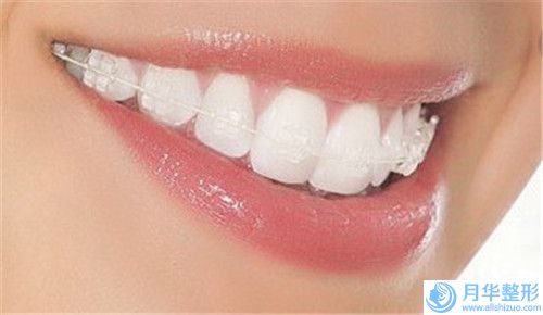 全國腿部抽脂醫(yī)院推薦：腿部抽脂醫(yī)院TOP50專個是誰