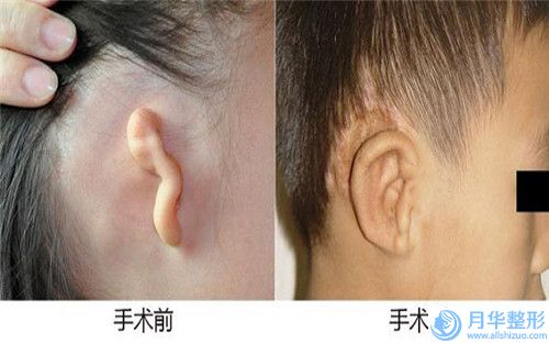 南京市假體豐乳隆胸整形醫(yī)生哪個比較有實力-夏云醫(yī)生更有名氣