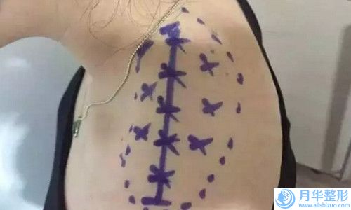 國內(nèi)小臉磨骨術醫(yī)院推薦：小臉磨骨術醫(yī)院top50強私藏分享