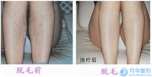 東莞市面部精確吸脂醫(yī)生排行前十佳一覽表發(fā)布-東莞市面部精確吸脂整形醫(yī)生