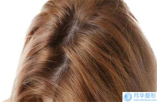 南京冠廷醫(yī)療美容價格價位表及案例搶先看-面部保妥適瘦臉案例