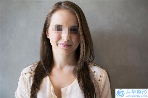 北京仁康健診所口腔科Y-V成形法眉位不正整形術(shù)危險可以避免嗎