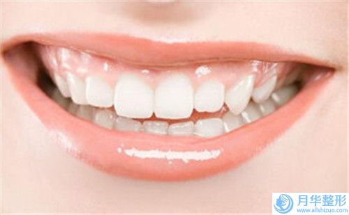 黃南儒大腿去脂塑形價(jià)格影響因素有哪些