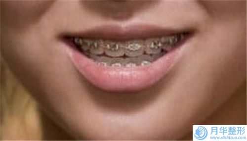 常州市超聲抽脂術(shù)醫(yī)生排行榜當(dāng)?shù)厝藦?qiáng)烈推薦的專業(yè)整形專位-傅軍醫(yī)生口碑都比較靠前