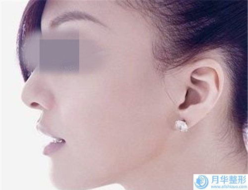 全國男士乳頭縮小手術(shù)醫(yī)院推薦：男士乳頭縮小手術(shù)醫(yī)院前50佳口腔機(jī)構(gòu)名單公布