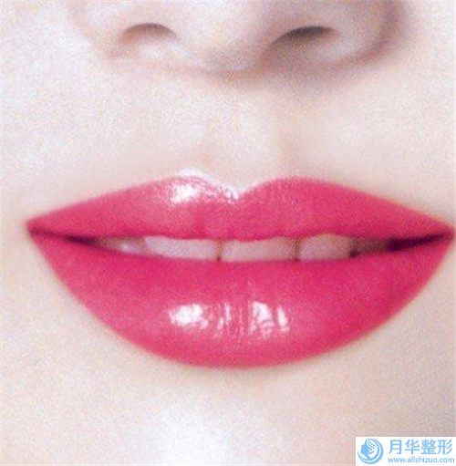 全國(guó)哪家吸脂去掉雙下巴醫(yī)院：吸脂去掉雙下巴醫(yī)院前50名名單種草