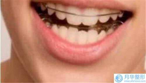 滄州手臂溶脂針后是否會(huì)影響正常生活