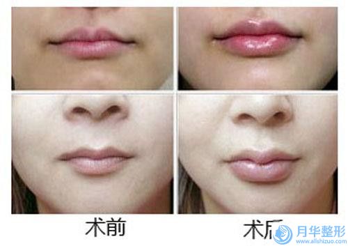 全國(guó)整雙下巴醫(yī)院推薦：整雙下巴醫(yī)院強(qiáng)榜前50口碑醫(yī)美機(jī)構(gòu)