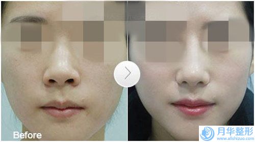 國內唇裂鼻子修復醫(yī)院推薦：唇裂鼻子修復醫(yī)院綜合實力前50醫(yī)美機構匯總