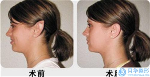 萊蕪市胸部假體隆胸醫(yī)生上榜清單權(quán)威篩選終于入圍了（王乃俊醫(yī)生實(shí)力在線值得選擇）