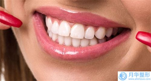 廣州腿部抽脂瘦腿價(jià)格的3個(gè)因素