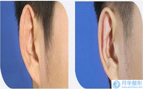 蚌埠市做乳房縮小價(jià)格表全新價(jià)(近6個(gè)月均價(jià)為：33223元)