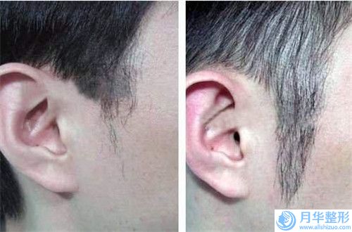 濱州市縫針白色疤痕去除價(jià)目表超人氣項(xiàng)目全面一覽(縫針白色疤痕去除費(fèi)用大概是多少錢(qián))