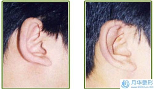 魏端欽治療激光脫腋毛后是否會(huì)影響哺乳