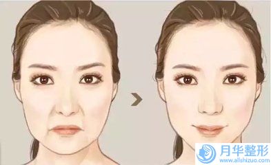 呂劍升激光消除色素痣對(duì)生孩子有影響嗎