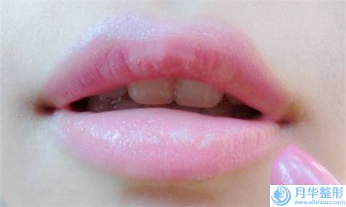 松原玻尿酸豐下巴手術(shù)的費(fèi)用一般要多少錢(qián)的呢