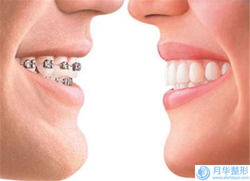 運(yùn)城現(xiàn)代佳美口腔做臀部吸脂術(shù)怎么樣
