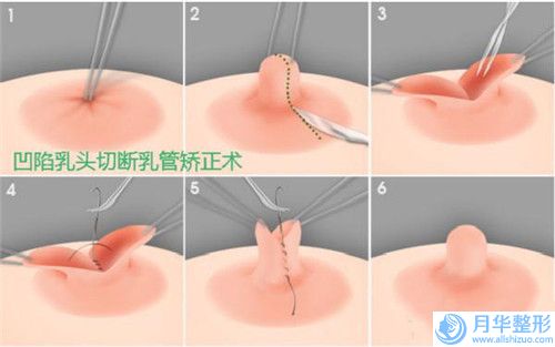 瀘州自體脂肪移植豐額頭術(shù)大概費(fèi)用大概是多少