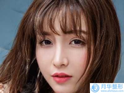 鼻孔開大術(shù)術(shù)可以保持多久時間