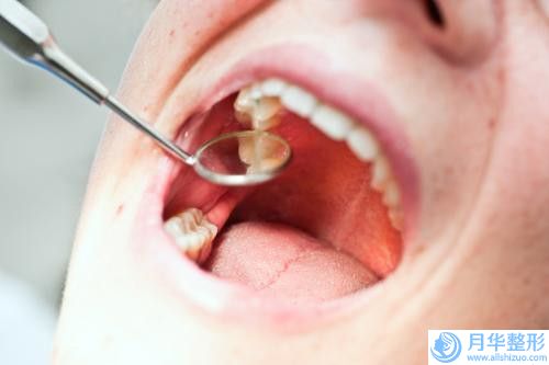 甘桂秋整形醫(yī)生吸脂肪減肥在各項技術(shù)上各有特色-廣東省中山市人民醫(yī)院