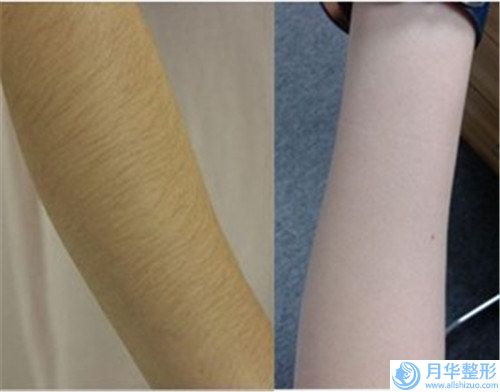 廣州藝美醫(yī)療口腔中心注射咬肌瘦臉在哪里做比較安全