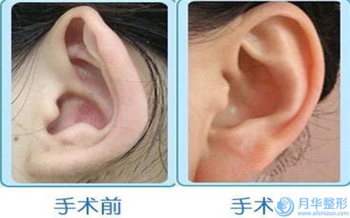 溫州市乳房一大一小整形醫(yī)院上榜名單前10名2024揭曉-溫州恒美醫(yī)療美容
