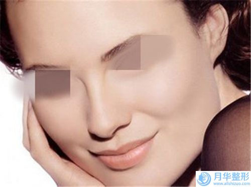 廊坊艾美皮膚激光整形門診部?jī)r(jià)格(價(jià)目)表信息上線-鼻部雙葉皮瓣修復(fù)案例
