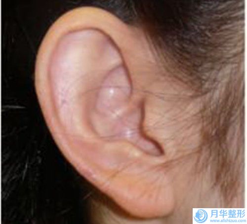 西電集團(tuán)醫(yī)院去做隆胸手術(shù)治療方法和價(jià)格