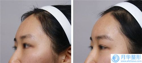 中國輕氧眉好醫(yī)生：輕氧眉醫(yī)生前50強專個盤點
