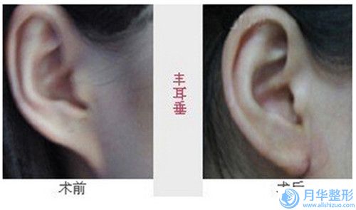 西雙版納乳牙根管治療費用大概是多少區(qū)間