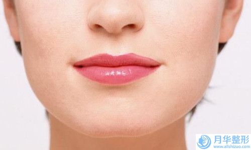 丁文婷醫(yī)生抽脂下巴案例-價(jià)位表案例及