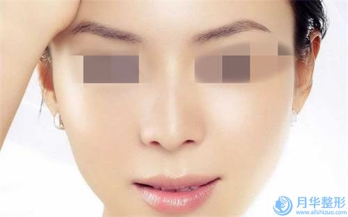 寬鼻骨縮窄手術三甲醫(yī)院推薦：寬鼻骨縮窄手術醫(yī)院top30強口碑深扒
