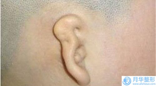 蕪湖雙環(huán)法矯正乳房下垂術(shù)的價(jià)格的因素