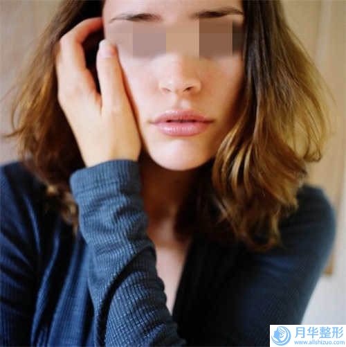唐山做隆下巴的價格會不會很高