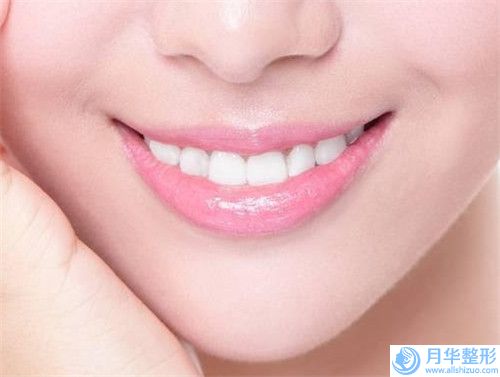 安慶雙固化樹脂粘全瓷冠后護(hù)理7細(xì)節(jié)