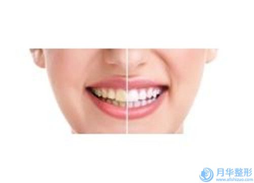深圳博愛整形美容醫(yī)院整形價(jià)格表(費(fèi)用)種草經(jīng)典項(xiàng)目-做腰腹部吸脂術(shù)案例