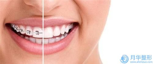 揚州瘦大腿肚子手術費用價格多少錢